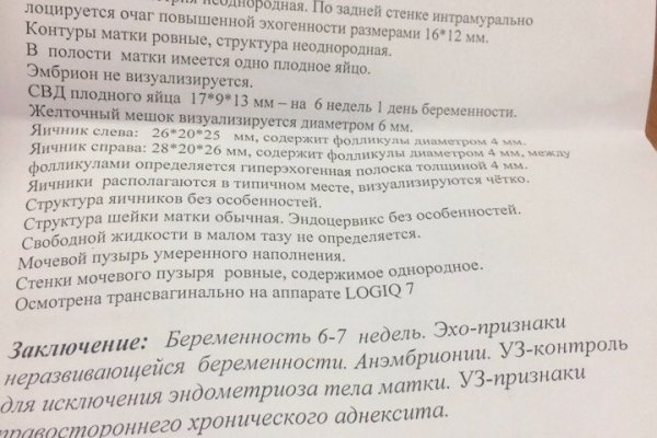 Что вместо гидры